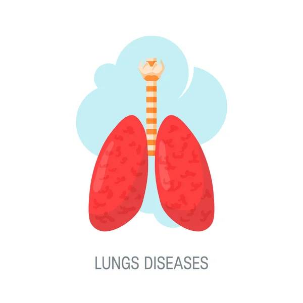 Concepto de vector de enfermedades pulmonares humanas en estilo plano — Vector de stock