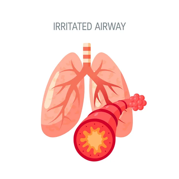 Irritado icono de vector de pulmones en estilo plano — Vector de stock