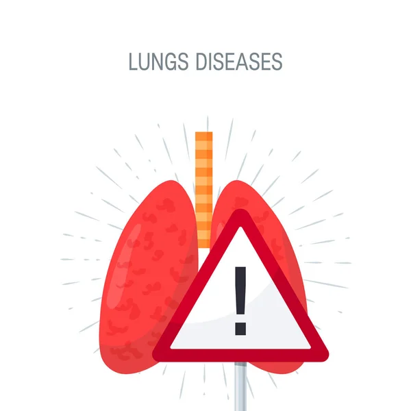 Concepto de vector de enfermedades pulmonares humanas en estilo plano — Archivo Imágenes Vectoriales