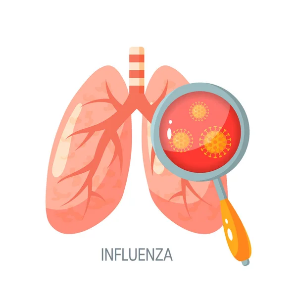 Influenza enfermedad vector icono en estilo plano — Vector de stock