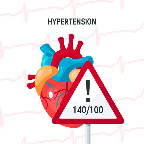 Concepto de presión arterial en estilo plano, vector — Vector de stock