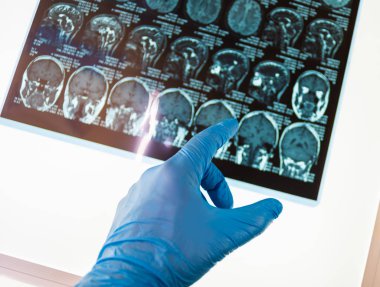 Doktor beyin x-ray görüntü üzerinde işaret