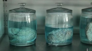 Laboratuvarda insan organı, insan beyni