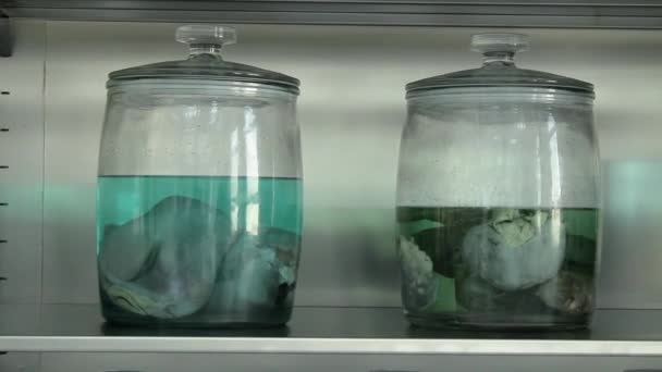 实验室里的人体器官人类大脑 — 图库视频影像