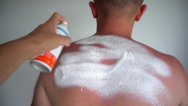 手スプレーと日焼けした男性の皮膚を損傷した日焼けした日焼けした男性の肌に特別な薬のパンテノールを適用します — ストック動画