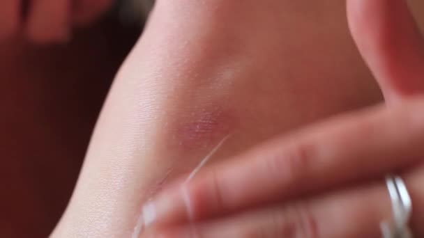 Meisjes hand uitstrijkjes kneuzing zalf — Stockvideo