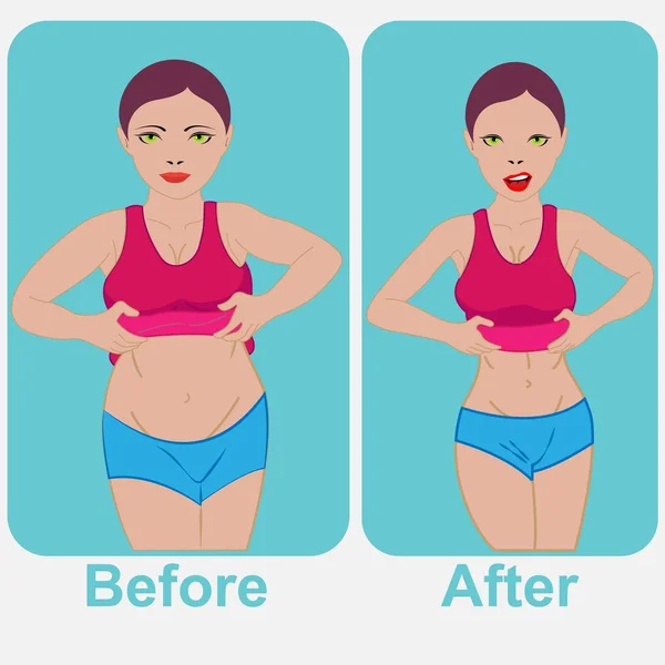 Kilo kaybı öncesi ve sonrası bir kadının vücut