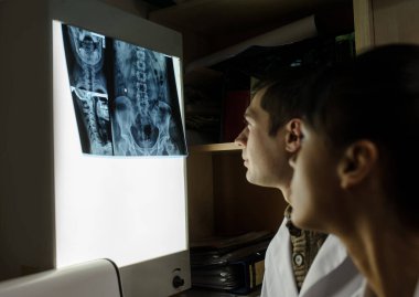 Yan görüş: Omurilik röntgenini araştıran iki doktorun resmi: bel ve boyun bölgesi - ilk 2 servikal omurga (eksen ve atlas), coxofemural eklem eklemi