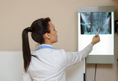 Omurilik röntgenini araştıran bir kadının resmi: bel ve boyun bölgesi - ilk 2 boyun omuru (eksen ve atlas), coxofemural eklem