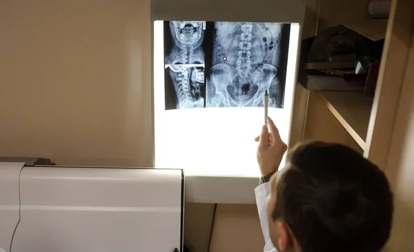 Vista Vicino Immagine Del Medico Che Esplora Radiografia Spinale Regione — Foto Stock