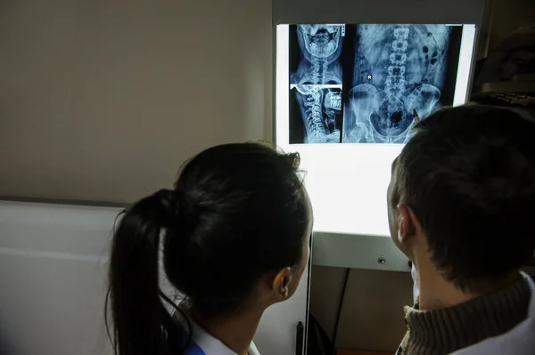 Vista Vicino Immagine Due Medici Che Esplorano Radiografia Spinale Regione — Foto Stock