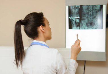 Omurilik röntgenini araştıran bir kadının resmi: bel ve boyun bölgesi - ilk 2 boyun omuru (eksen ve atlas), coxofemural eklem