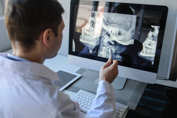 Seitenansicht Eines Männlichen Radiologen Bei Der Untersuchung Von Hals Röntgenaufnahmen — Stockfoto