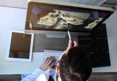 Bilgisayarda boyun röntgenlerini (boyun omurgası) inceleyen bir erkek radyologun üst görüntüsü