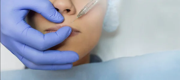 Zbliżenie Zabiegu Powiększenia Ust Młodej Kobiety Wykonanego Przez Lekarza Kosmetologa — Zdjęcie stockowe