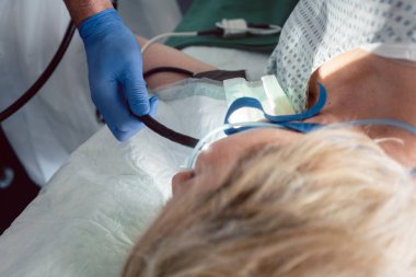 Doktor Gastroskopi sırasında endoskop kamera ekleme