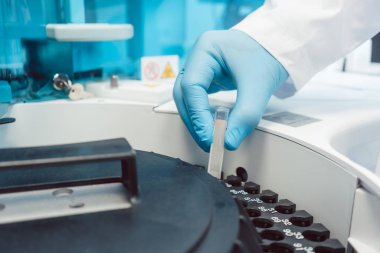 Doktor kan tüpler santrifüj makinesi için test koyarak
