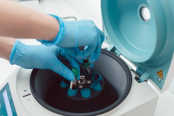 Lékař nebo laboratorní technik uvádění vzorky krve v centrifugační — Stock fotografie