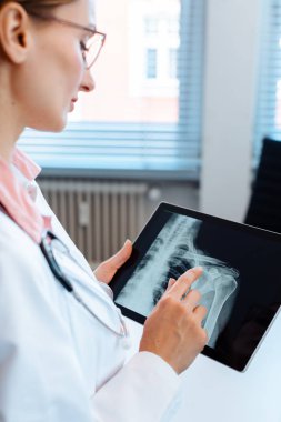 Doktor Röntgen resmi bir omuz onun tablet bilgisayarda bakarak