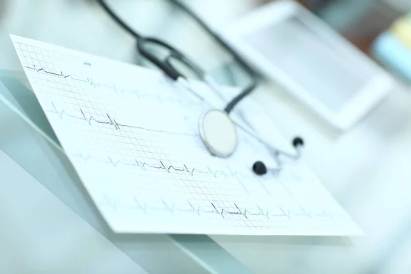 Stethoscoop en cardiogram op een medische tafel — Stockfoto