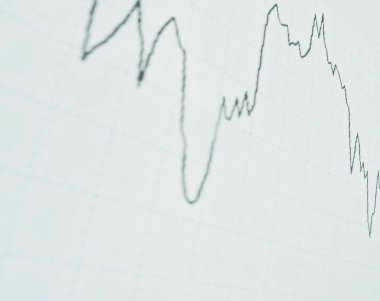 bir table.close kadar iş grafikte arka plan görüntüsü