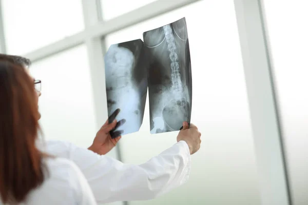 Gruppen av läkare diskuterar patienter röntgen. — Stockfoto
