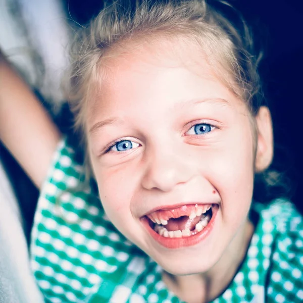 Roztomilý úsměv holčička bez předních zubů — Stock fotografie