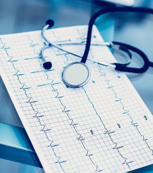 Stethoscoop en elektrocardiogram op de tafel van de Therapi — Stockfoto