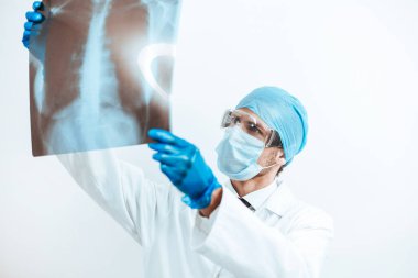 Kapat. Doktor akciğerlerin röntgenine bakıyor..