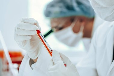 Laboratuvar asistanının ellerinde Coronavirus testi olan etiketli bir tüpün arkaplan resmi.