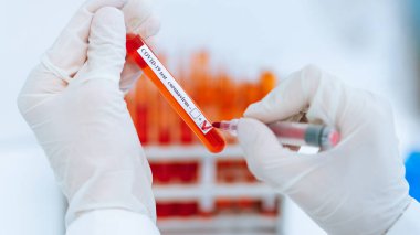 Bilim adamı test tüpünün üzerine bir işaret koyuyor..