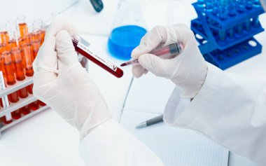 Kapat. Laboratuvar teknisyeni onaylanmış bir testi işaretliyor..