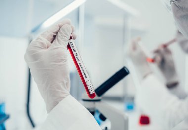 Kapat. Sıhhiyenin elinde test olan tüp..