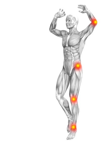 赤と黄色のホット スポットの炎症や医療療法やスポーツ概念の関節の関節痛と概念的な筋の解剖学 イラストの人関節炎や骨骨粗鬆症病 — ストック写真