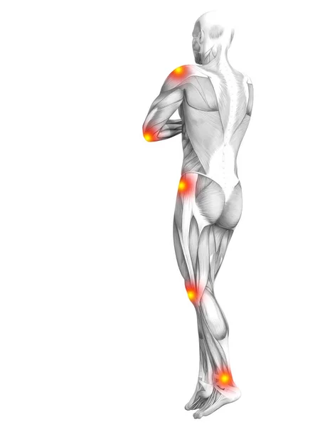 빨간색과 노란색 스포츠 치료에 개념적 인간의 해부학 관절염 골다공증 — 스톡 사진