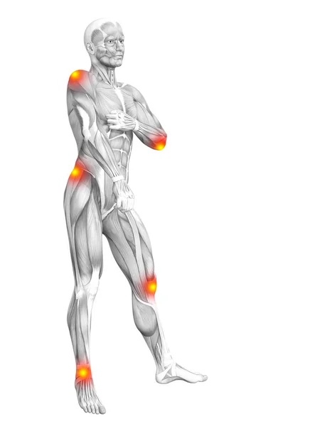 赤と黄色のホット スポットの炎症や医療療法やスポーツ概念の関節の関節痛と概念的な筋の解剖学 イラストの人関節炎や骨骨粗鬆症病 — ストック写真