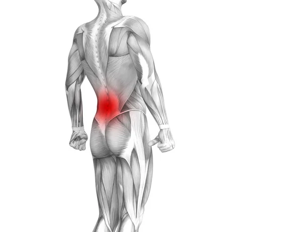 Konzeptionelle Anatomie Des Rückens Bei Roter Hotspot Entzündung Gelenkschmerzen Oder — Stockfoto