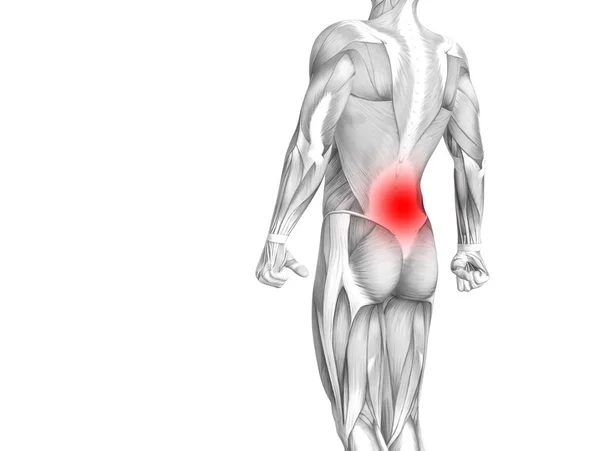 Menschliche Anatomie Mit Roter Hotspot Entzündung — Stockfoto