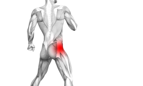赤ホット スポット炎症関節関節痛足医療療法またはスポーツ筋概念と概念ヒップ人体解剖 イラスト人関節炎や骨痛骨粗鬆症病 — ストック写真