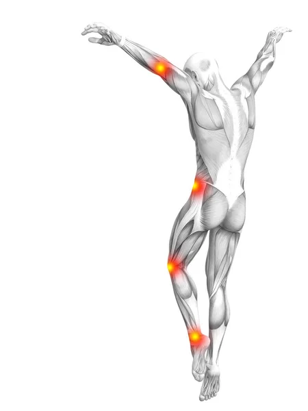 Концептуальна Анатомія Людських Язів Запаленням Червоної Жовтої Гарячої Точки Або — стокове фото
