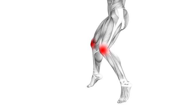 Conceptuele Knie Anatomie Met Rode Hotspot Ontsteking Articulaire Gewrichtspijn Voor — Stockfoto