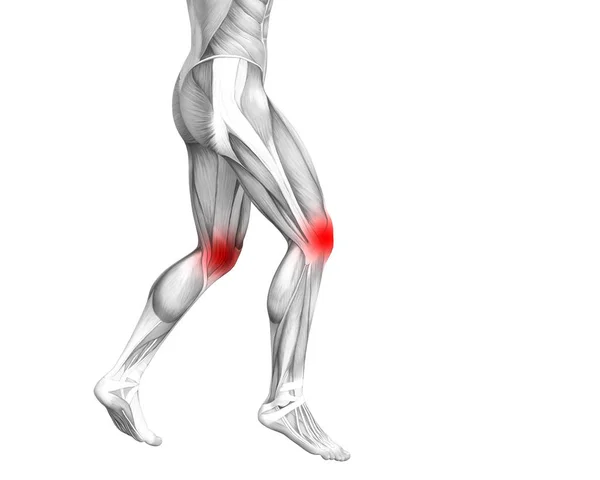 Conceptuele Knie Anatomie Met Rode Hotspot Ontsteking Articulaire Gewrichtspijn Voor — Stockfoto