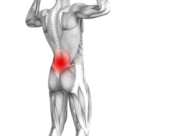 赤ホット スポット炎症関節関節痛や脊椎医療療法やスポーツ筋概念と概念の戻って人間の解剖学 イラスト人関節炎や骨痛骨粗鬆症病 — ストック写真
