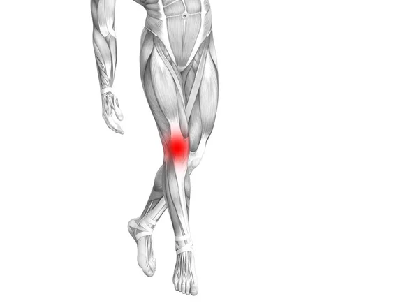 Conceptual Knee Human Anatomy Red Hot Spot Inflammation Articular Joint — Stock Photo, Image