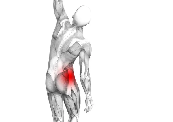 Anatomia Humana Quadril Conceitual Com Inflamação Ponto Quente Vermelho Dor — Fotografia de Stock