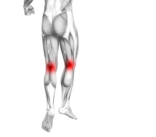 Anatomie Conceptuelle Genou Humain Avec Inflammation Des Points Chauds Rouges — Photo