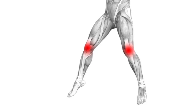 Conceptuele Knie Anatomie Met Rode Hotspot Ontsteking Articulaire Gewrichtspijn Voor — Stockfoto