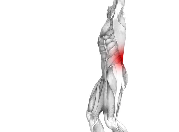 赤ホット スポット炎症関節関節痛や脊椎医療療法やスポーツ筋概念と概念の戻って人間の解剖学 イラスト人関節炎や骨痛骨粗鬆症病 — ストック写真