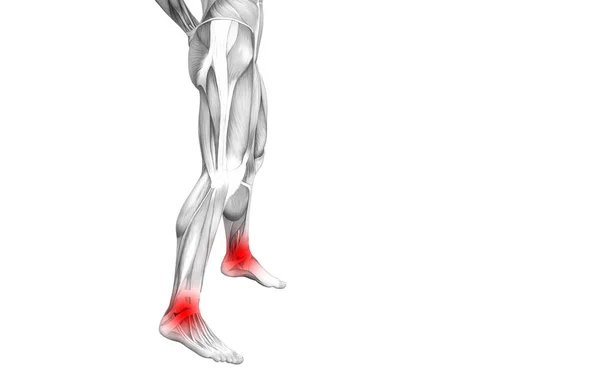 Conceptual Ankle Human Anatomy Red Hot Spot Inflammation Articular Joint — Stock Photo, Image