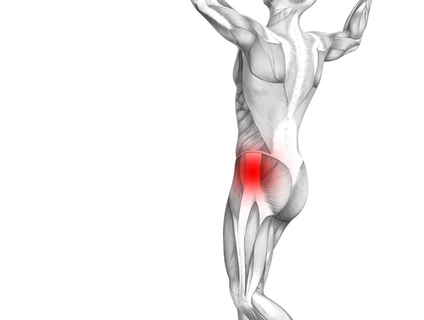 赤ホット スポット炎症関節関節痛足医療療法またはスポーツ筋概念と概念ヒップ人体解剖 イラスト人関節炎や骨痛骨粗鬆症病 — ストック写真
